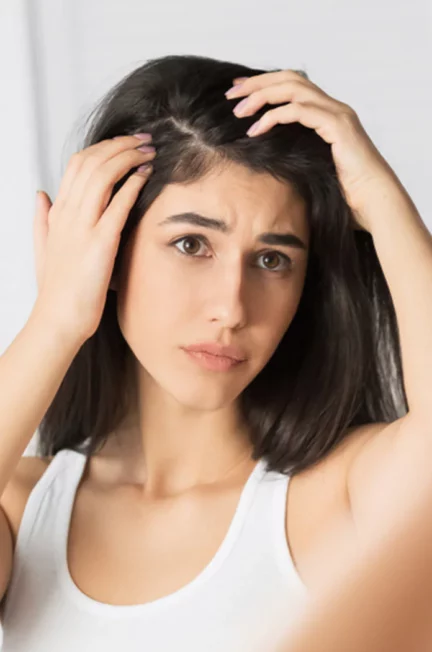 How to Cure Dandruff in Winters: Natural Remedies and Tips